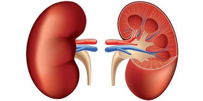 Kidney Stones and Their Causes